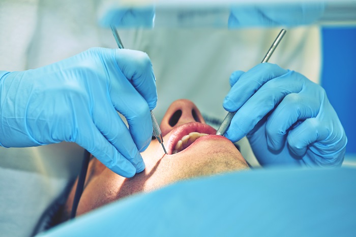 Implantes dentales para mejorar la sonrisa